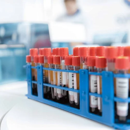 Diagnostics Reagents